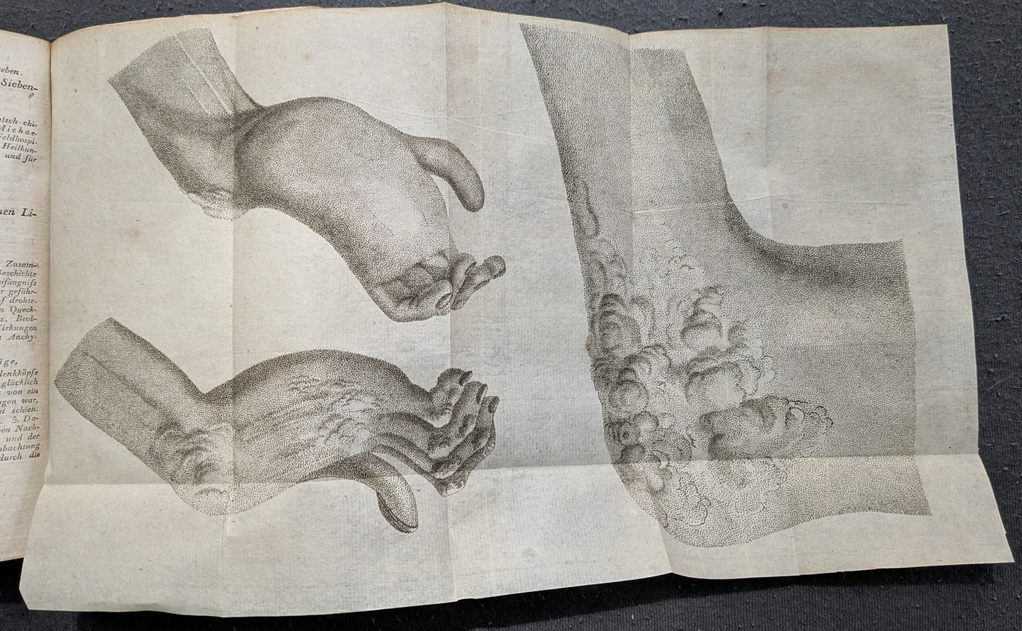 Neues Journal der practischen Arzneykunde und Wundarzneykunst - 1802